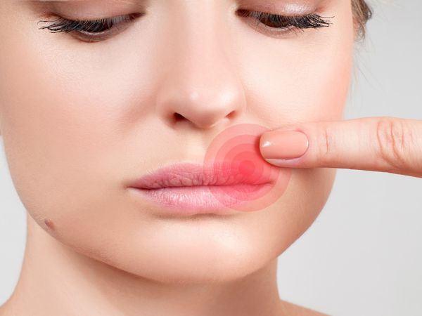 Parapharmacie vente en ligne de produits Herpès Dermatologie