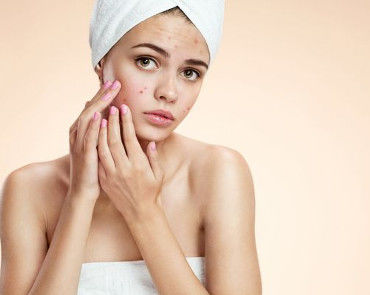 Parapharmacie vente en ligne de produits Acné Dermatologie