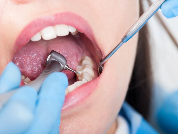 Parapharmacie vente en ligne de produits Plaque Dentaire Dentaire