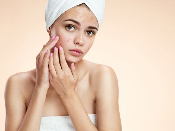 Parapharmacie vente en ligne de produits Peaux Sèches / Acné Peau