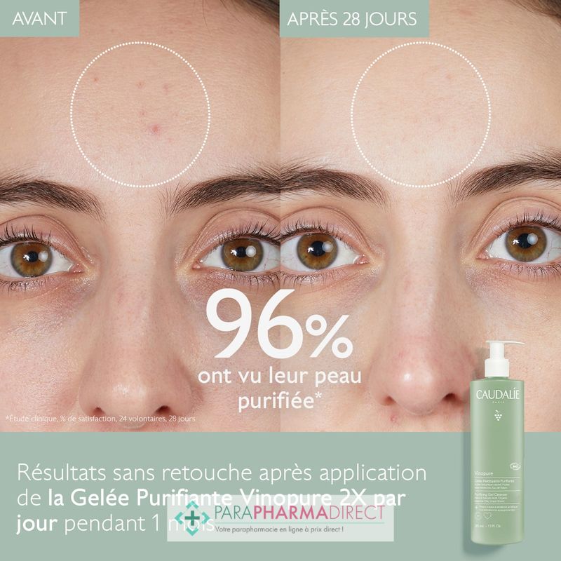 Masque anti-points noirs à l'extrait d'aloe vera pour visage - Prix en  Algérie