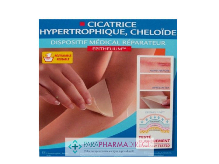 CICA-CARE - Plaque de gel de silicone pour cicatrices hypertrophiques et  chéloïdes - FM Medical